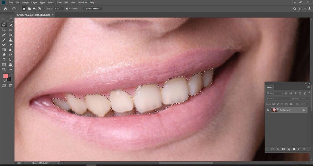 Make a selection throughout the teeth